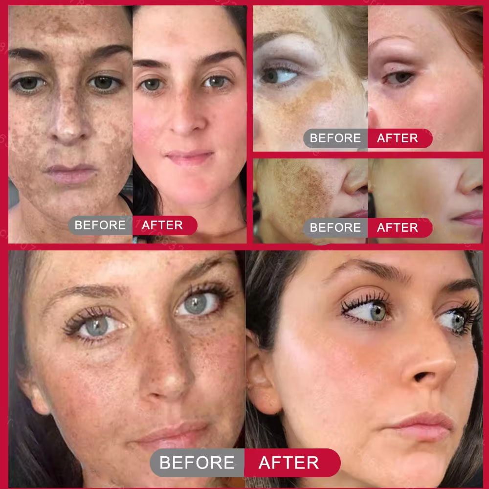 Powerful Spot-removing Whiteni - Vitamin C Serum Face 评论和价格